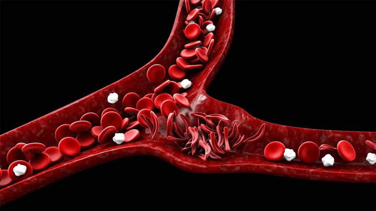 anemia.jpg