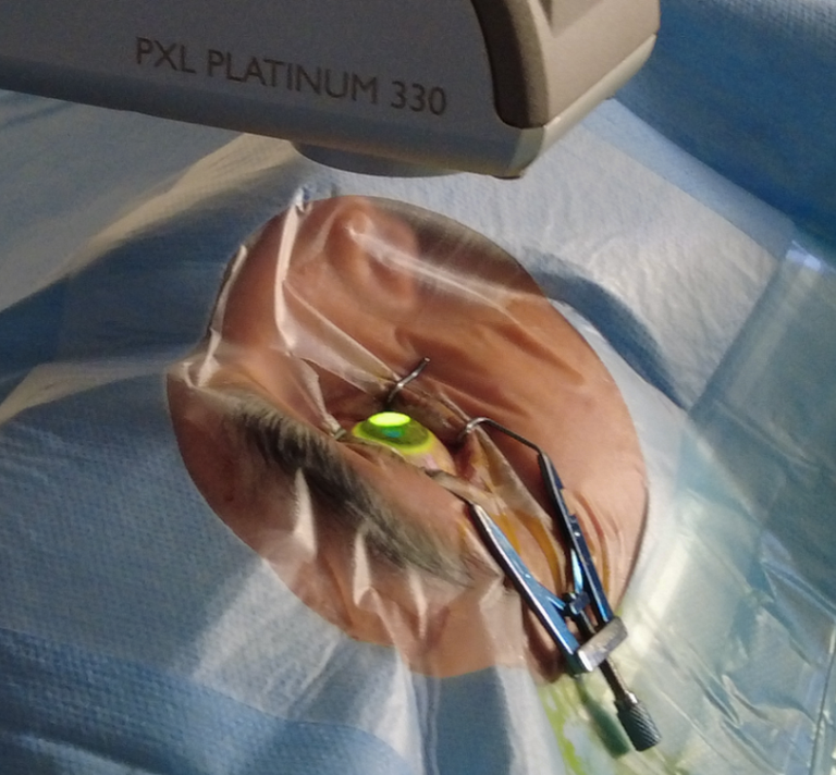 crosslinking