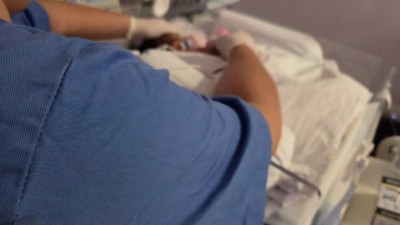 UTI Neonatal do Hucam-Ufes atinge mais de 270 dias sem Pneumonia Associada à Ventilação Mecânica