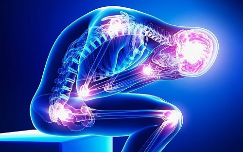 Fibromialgia