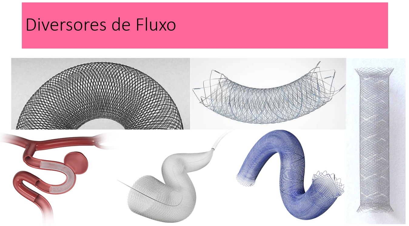 Imagem dos diversores de fluxo ou stents utilizados no procedimento