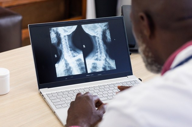 Sistema de Telerradiologia da Rede HU Brasil ultrapassa meio milhão de exames e facilita acesso da população aos hospitais universitários