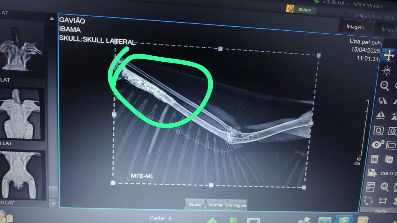 2025-05-20 Raio X da asa esquerda da ave mostra fragmentos de chumbo na parte circulada.jpg