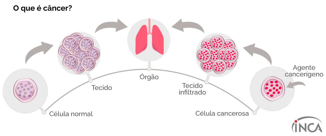 Célula normal > Tecido > Órgão < Tecido infiltrado < Célula cancerosa < Agente cancerígeno