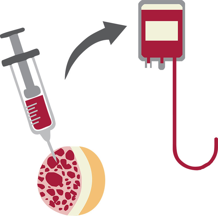 img-tratamento-transplante-medula-ossea-capa.jpg