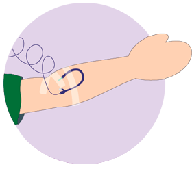 img-tratamento-transplante-medula-ossea-cateter-venoso.png