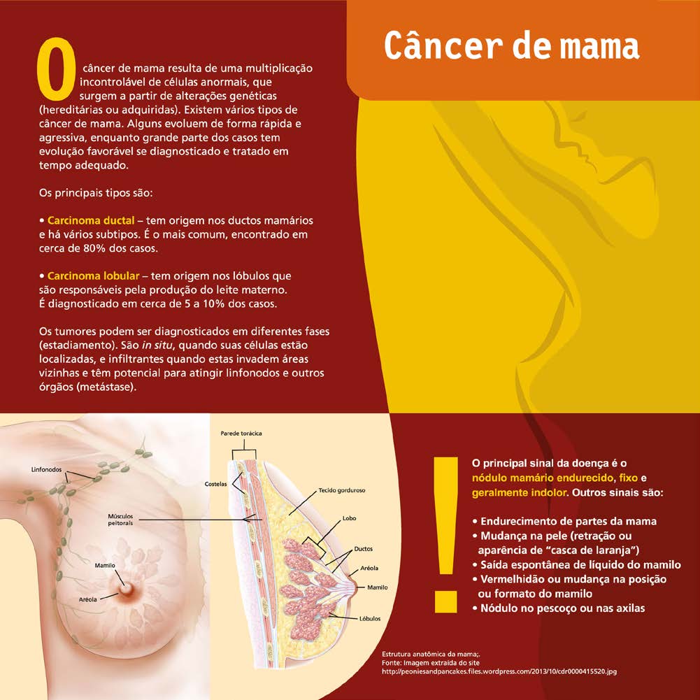 Os principais tipos são: carcinoma ductal e lobular.