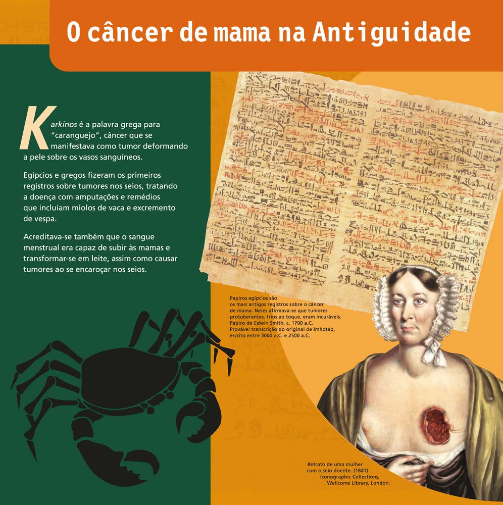 Os egípcios e gregos fizeram os primeiros registros sobre tumores nos seios.