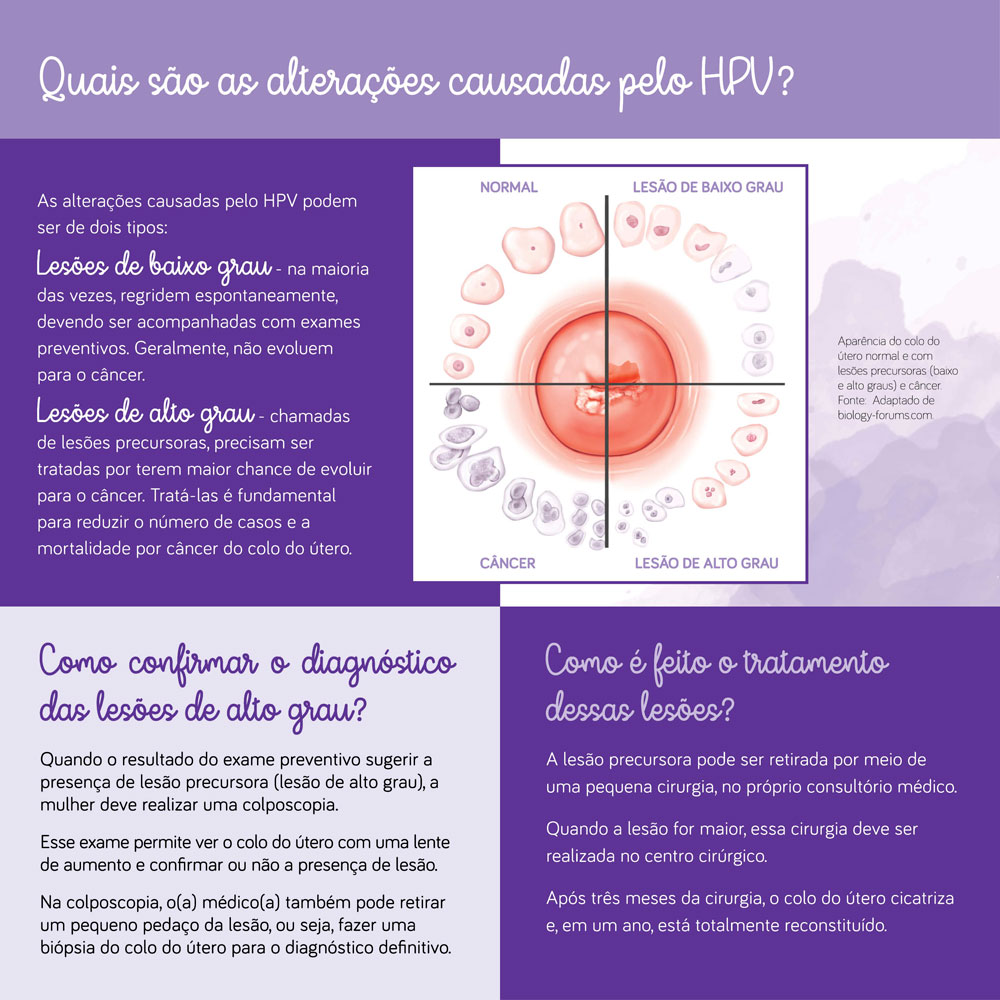 As alterações causadas pelo HPV podem ser lesões de baixo grau e alto grau.