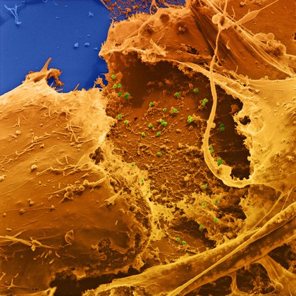 As partículas do vírus MPXV (em verde) envolvem uma célula hospedeira