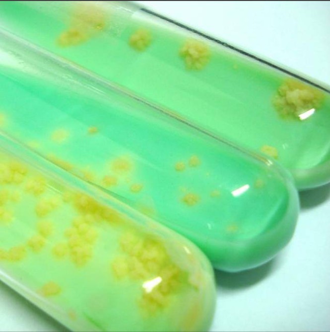 Mycobacterium tuberculosis.jpg