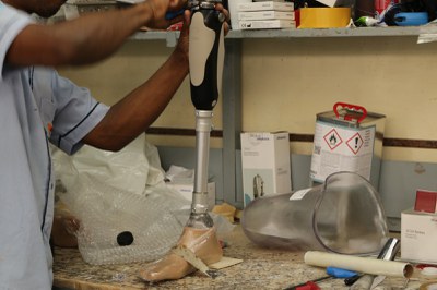 INSS avança na reabilitação com entrega de próteses em Vitória