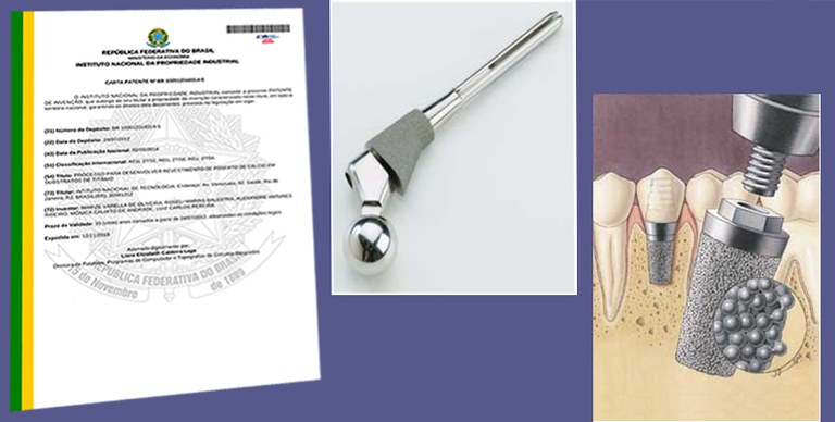 Carta_Patente_-_revestimento_de_implantes-ilustração2