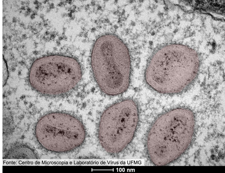 Centro de Microscopia da UFMG_Monkeypox_virus.jpg