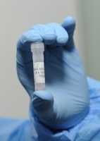 MCTI, Fiocruz e UFMG firmam protocolo de intenções para desenvolver vacina contra monkeypox