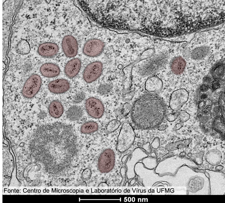 4_Centro de Microscopia da UFMG_Monkeypox_virus1.jpg