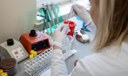 Anvisa aprova oito novos testes de diagnóstico para Covid-19