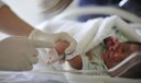 SUS vai ofertar exame de toxoplasmose congênita para recém-nascidos