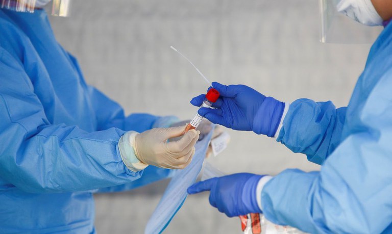 Saúde vai adquirir mais 46 milhões de testes de diagnóstico do novo coronavírus