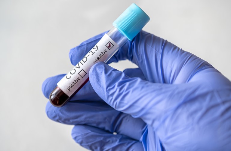 Dois milhões de testes para diagnóstico da covid-19 já foram disponibilizados