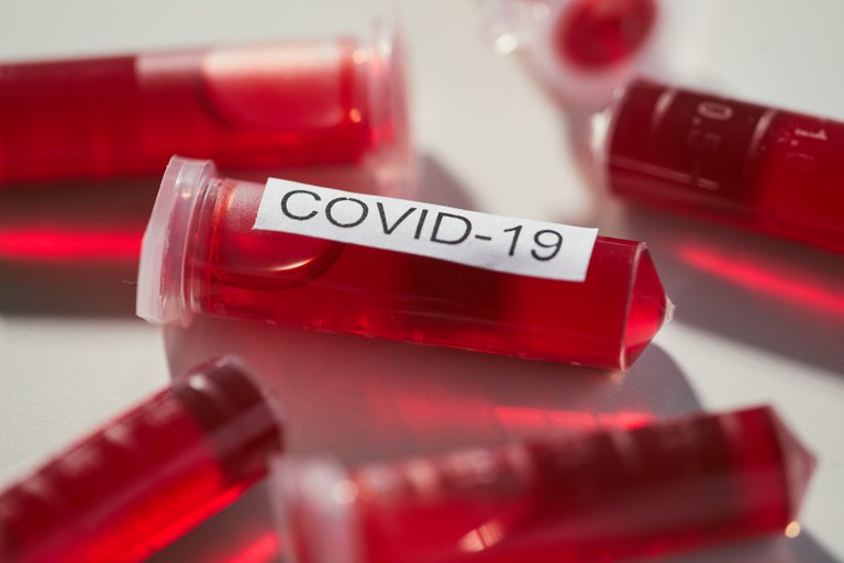Mais de 15 mil pessoas já foram testadas em pesquisa de anticorpos contra a covid-19