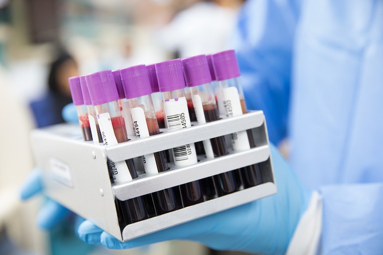 Pesquisa vai utilizar plasma sanguíneo em pacientes infectados com Covid-19