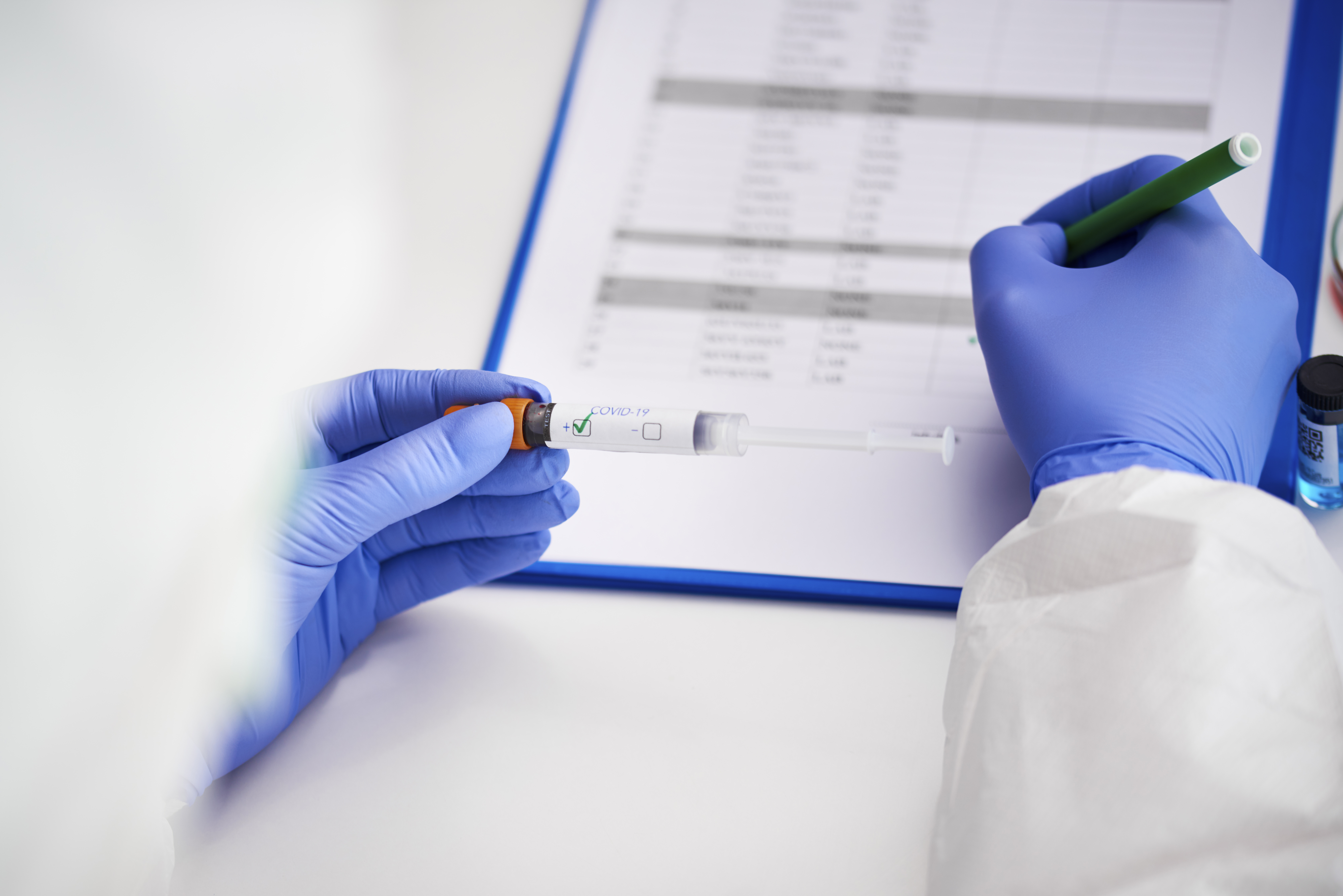 Agência Nacional de Saúde inclui o teste sorológico ao Rol de Procedimentos e Eventos em Saúde