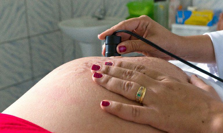 Atenção para as grávidas tem reforço de R$ 247 milhões