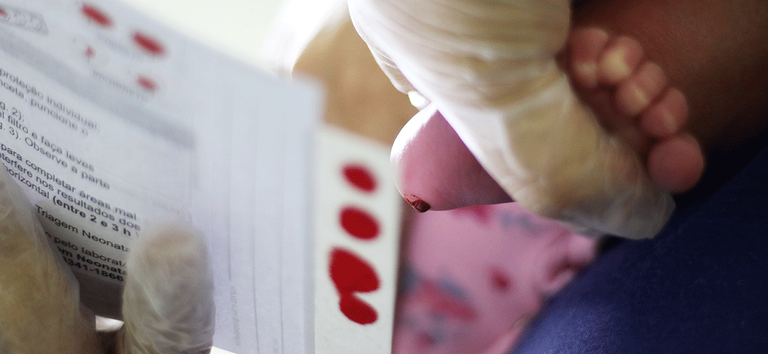 Na primeira etapa da ampliação do Teste do Pezinho, Governo Federal incorpora exame para toxoplasmose