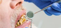 Doença periodontal é uma das principais causas de perda total de dentes; conheça outros tipos de infecções