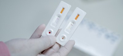 teste - haseniase - foto - myke sena ms (1).jpg