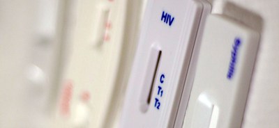 teste - hiv - foto - ms (2).jpg