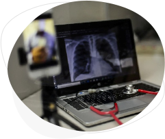 Imagem de notebook com aberta numa foto de Raio-x