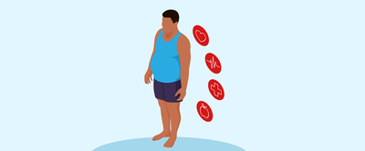 Texto 12 - O impacto econômico da obesidade_1280x530px.png