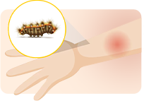 Imagem ilustrativa de um acidente com lagarta