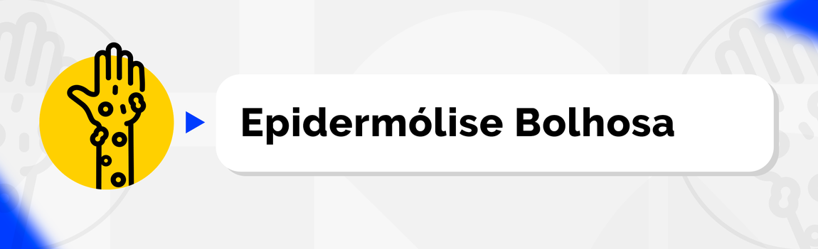 Epidermólise Bolhosa