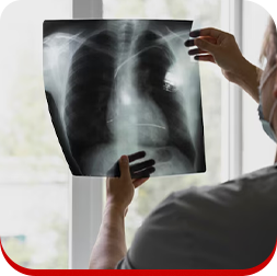 Profissional analisando exame de raio-x