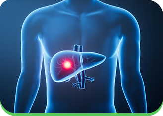 Imagem demonstrando paciente com hepatite