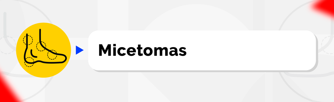 Micetomas