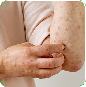 Ilustração da transmissão da mpox