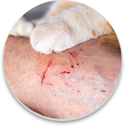 Foto de pessoa ferida