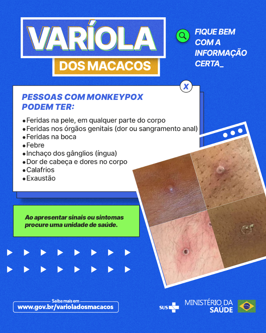 Card - Sintomas de quem tem monkeypox (png)