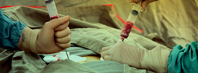 Transplante de medula óssea