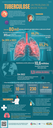 Infográfico - Tuberculose - um problema de saúde pública