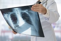 Bahia recebe R$ 38,8 milhões para avançar no Programa Mais Acesso a Especialistas