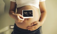 Governo propõe a instituição do Dia Nacional do Nascituro  e de Conscientização sobre os Riscos do Aborto