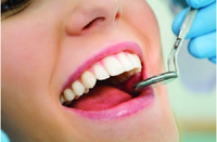 Semana Nacional de Prevenção do Câncer Bucal