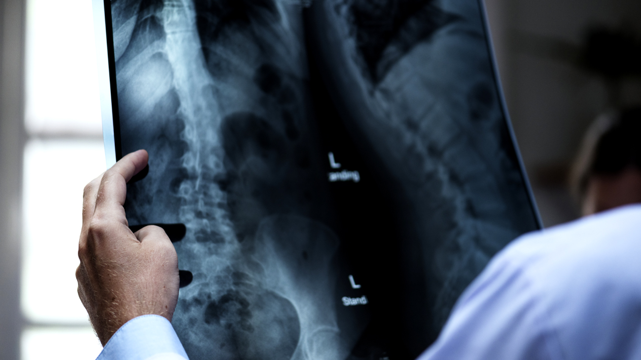 Um médico examina uma chapa de raios X
